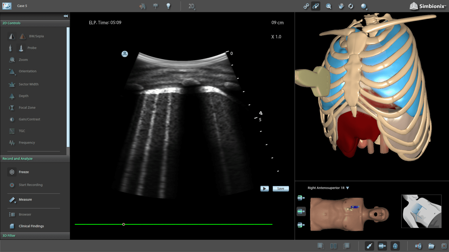 Simulateur d'échographie pulmonaire et COVID19 EchoFirst