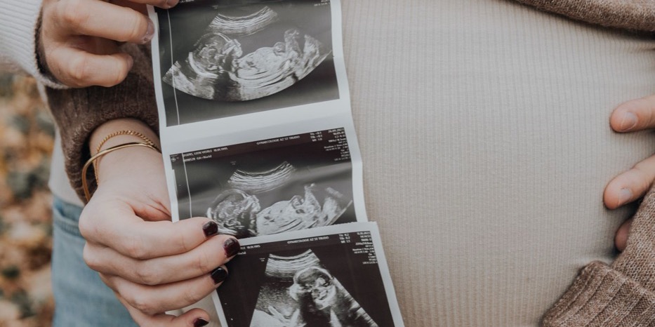 Femme enceinte tenant les clichés de son échographie du premier trimestre