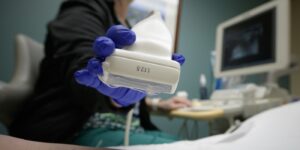 Main gantée de bleu tenant une sonde linéaire d'échographie, écran d'échographe flou en arrière-plan