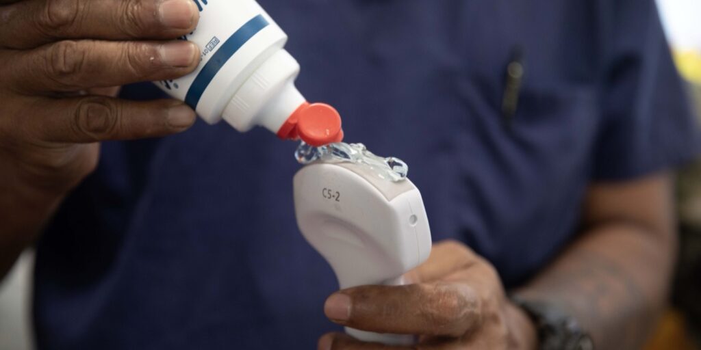 Praticien déposant du gel d'échographie sur une sonde convexe tenue dans la main